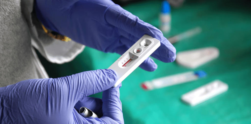 SIDA: emplearán autotests por primera vez en una iniciativa destinada a promover el diagnóstico&nbsp;temprano