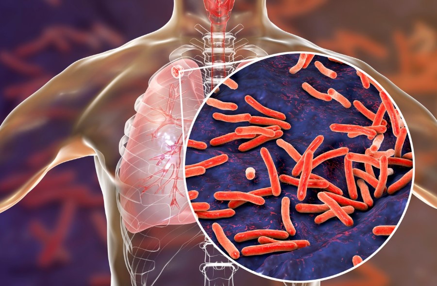 La lepra tiene cura y la atención a tiempo marca la&nbsp;diferencia