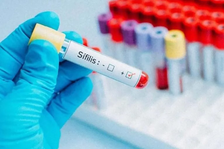 En Argentina se reportaron más de 50 mil contagios de&nbsp;sífilis