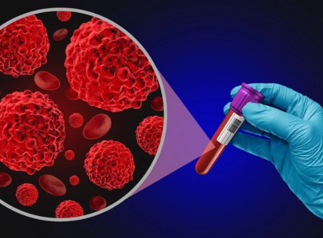 Alertan por el aumento de enfermedades oncohematológicas