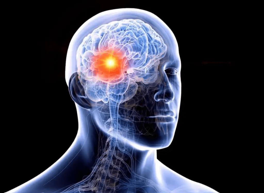 Vivir con epilepsia: los desafíos del miedo, la incertidumbre y el&nbsp;estigma
