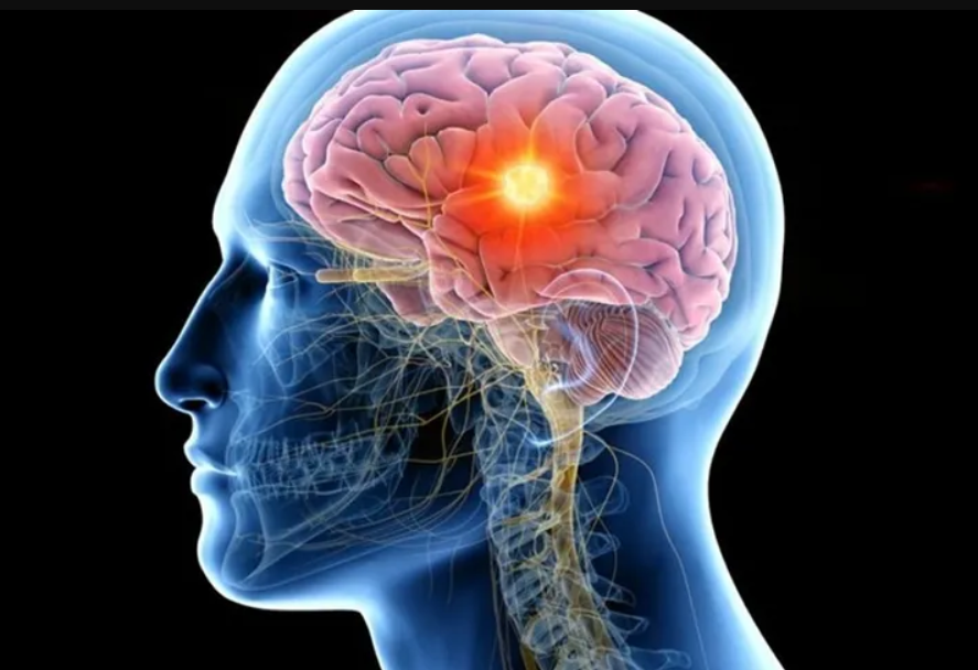 Cómo cuidar la salud cerebral y reducir el riesgo de enfermedades 