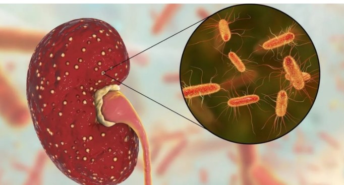 Las 10 claves para prevenir el Síndrome Urémico&nbsp;Hemolítico